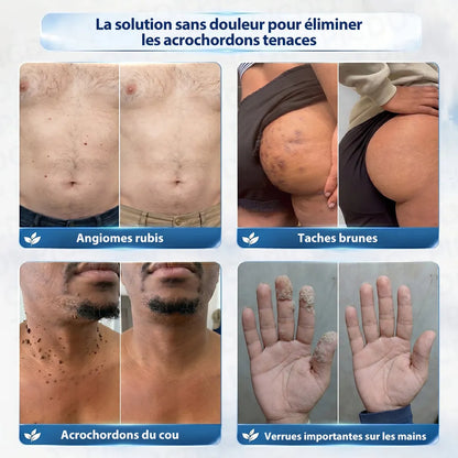 🎁 Bénéficiez de 40 % de réduction lorsque vous ajoutez un deuxième produit.