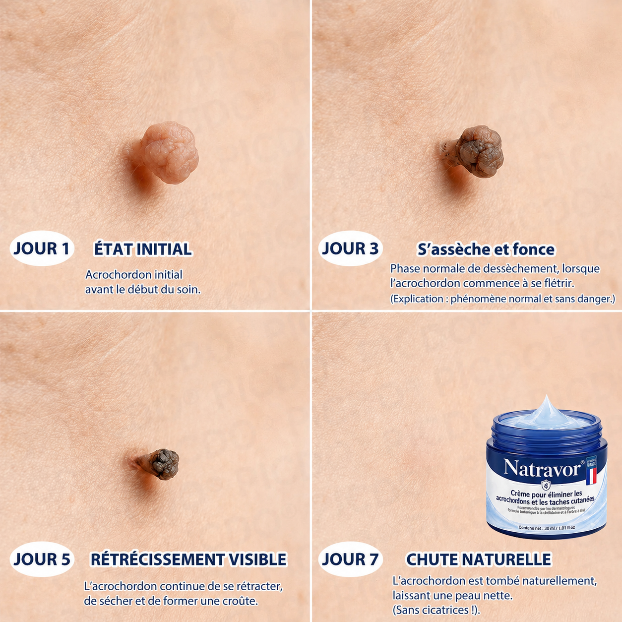 🎁 Bénéficiez de 40 % de réduction lorsque vous ajoutez un deuxième produit.