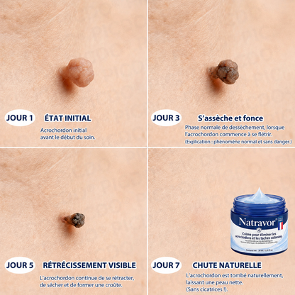 🎁 Bénéficiez de 40 % de réduction lorsque vous ajoutez un deuxième produit.
