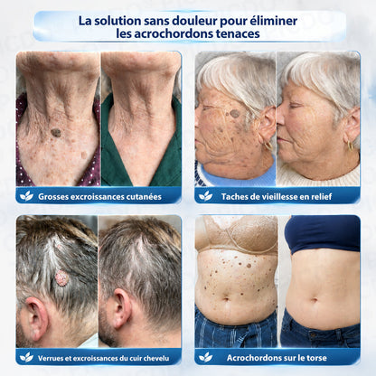 🎁 Bénéficiez de 40 % de réduction lorsque vous ajoutez un deuxième produit.